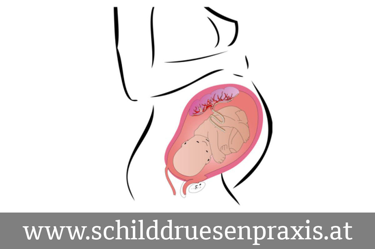 Schematische Zeichnung von Baby und Plazenta in der Gebärmutter